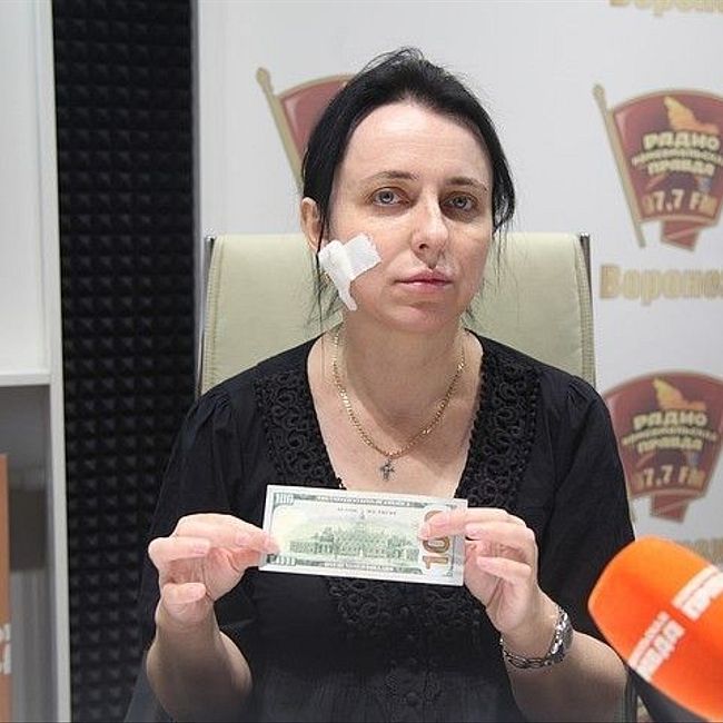 Жительница Воронежа: «В банке мне проткнули щеку канцелярским ножом!»
