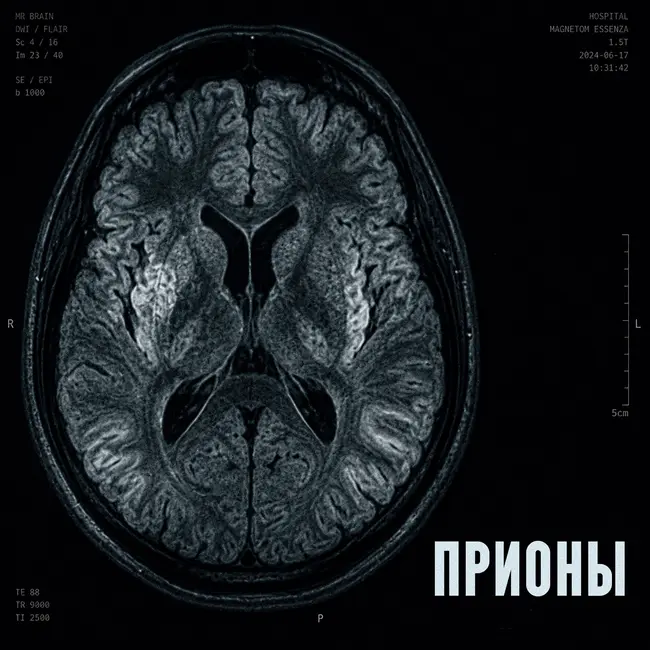 Прионы. Овцы, поедание мозгов и украденные дети