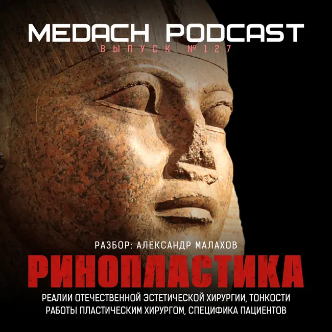 Александр Малахов | Ринопластика