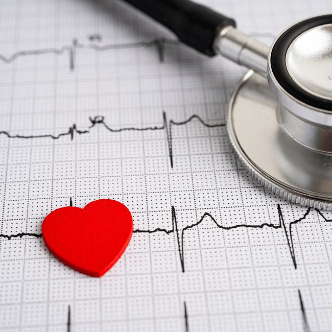Нарушение ритма сердца и панические атаки. Мифы, терапия и диагностика
