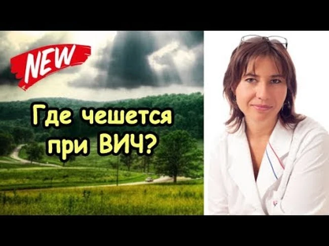 Где чешется при ВИЧ-инфекции и при сифилисе?