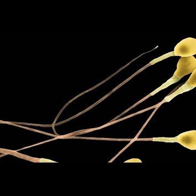 Фрагментация ДНК сперматозоидов