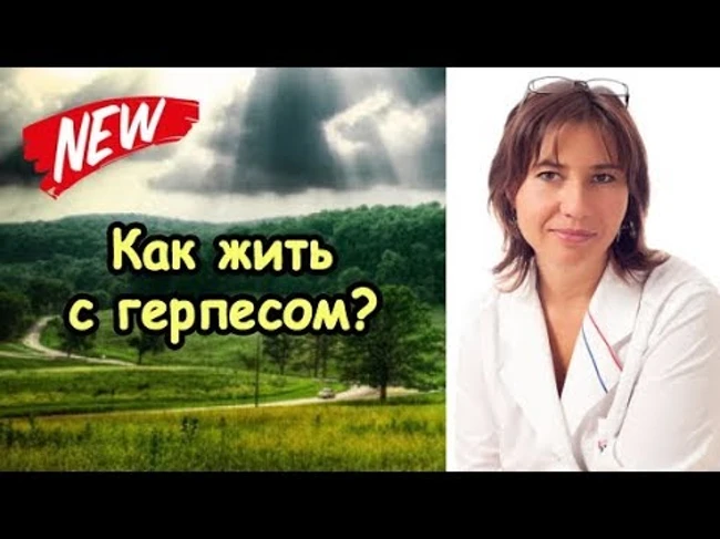 Как жить с герпесом?