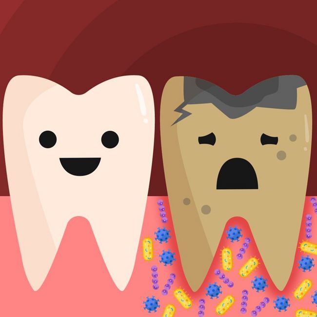 FAQ:  Что случится, если вы перестанете чистить зубы?