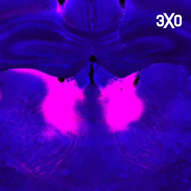 Учёные нашли мутацию, мешающую мозгу обновлять картину мира