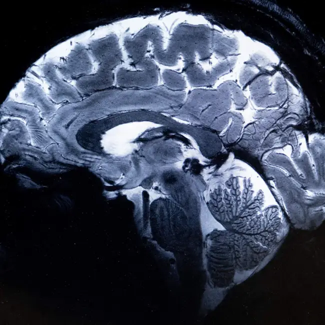 When is your brain actually an "adult"?