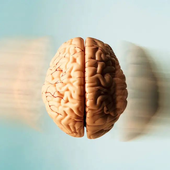 Our favorite brains, including Einstein's stolen one