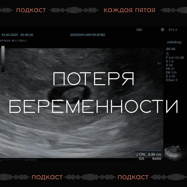 Гинеколог о замершей беременности