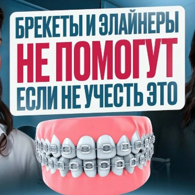 Трейлер 1 выпуска: Почему брекеты и элайнеры не помогут?