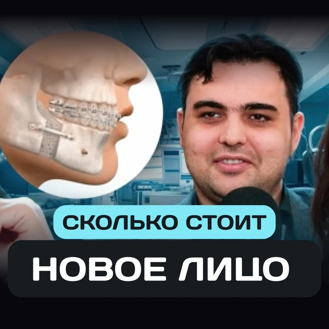 Трейлер 2 выпуска: Сколько стоит новое лицо?