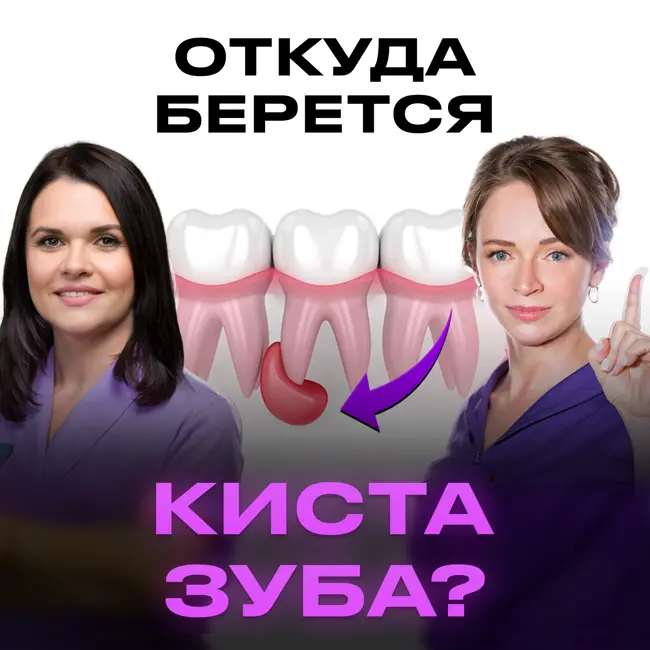 КИСТА ЗУБА. 5 ПРИЧИН ПОЯВЛЕНИЯ. ЛЕЧИТЬ ИЛИ УДАЛЯТЬ?
