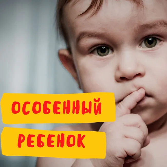 Атипичный аутизм