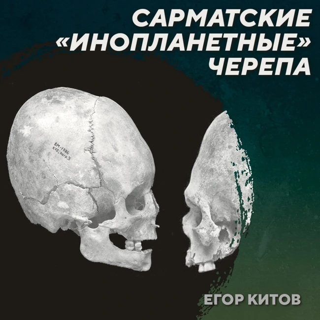 РС 426 Искусственная деформация черепов у сарматов. Егор Китов